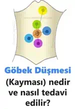 Göbek Düşmesi (Kayması) nedir ve nasıl tedavi edilir?