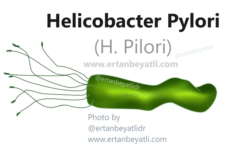 Helicobacter Pylori (H. Pilori) Helicobacter Pylori (H. Pilori)