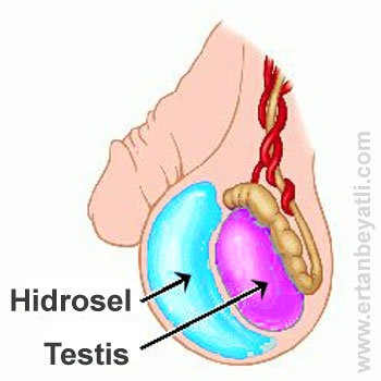 Hidrosel anatomisi