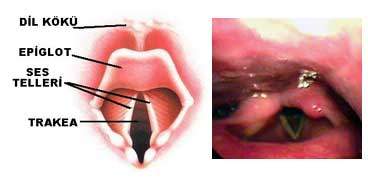 Orofarenks ve epiglottis bölgesi