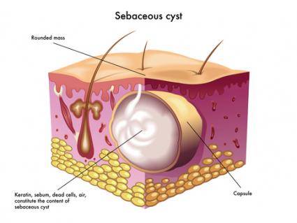 Sebase Kist