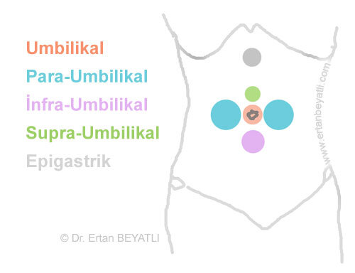 Umbilikal herni - Göbek Fıtığı