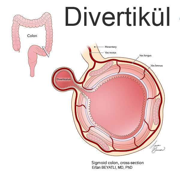 Kolon Divertikülü anatomisi