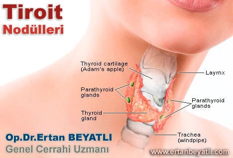 Tiroid nodülleri