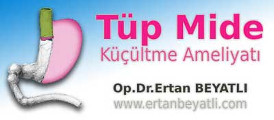 Tüp Mide