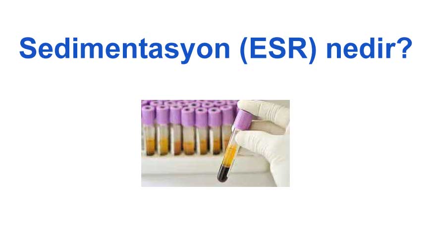 Sedimentation ESR