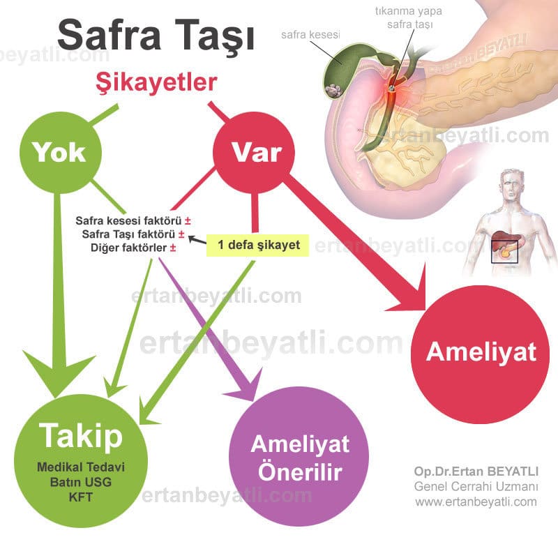 Safra kesesi taşı - algoritma