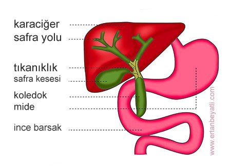 Postkolesistektomi Sendromu - PKS