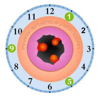 Saat yönlerine göre Hemoroid (Basur) dağılımı