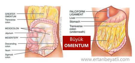 Omental Torsiyon nedir?