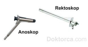 Rektoskopi ve anoskopi nedir ve nasıl yapılır?