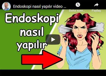 Endoskopi nasıl yapılır video (anestezi ile) - Dr. Ertan BEYATLI